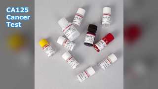 CA125 ELISA Τεστ για την παρακολούθηση του καρκίνου
