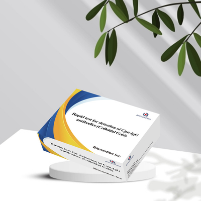 Χλαμιδιαπνευμονία (Cpn) - Αντισώμα IgM Κάρτα κολοειδούς χρυσού αντιδραστήρα ταχείας δοκιμής