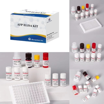 AFP Alpha Fetoprotein Elisa Test Kit Ενζυμικά συνδεδεμένα προϊόντα Σύντομο χρόνο μεταφοράς