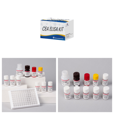 Υψηλής ευαισθησίας συσκευή Elisa για ιατρική διάγνωση με χρόνο εξέτασης 1 ώρας για δείγματα ορού 50μL