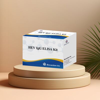 Κιτ ELISA HEV-IgG Υψηλής Ευαισθησίας με Μέγεθος 96T και Διάρκεια Ζωής 18 Μηνών για τη Διάγνωση της Ηπατίτιδας Ε