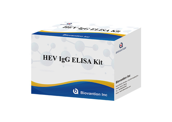 Ανθρώπινη Igg Elisa εξάρτηση HEV διαγνωστική για το αντίσωμα IgG στον ιό ηπατίτιδας Ε