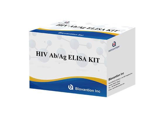 ISO13485 4η εξάρτηση της ELISA δοκιμής παραγωγής HIV δοκιμής HIV αβ Ag 60 λεπτά