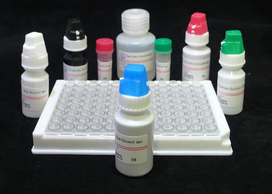 ISO13485 4η εξάρτηση της ELISA δοκιμής παραγωγής HIV δοκιμής HIV αβ Ag 60 λεπτά