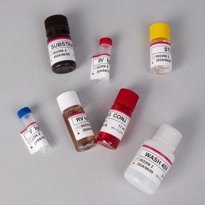 RV-G Elisa Test Kit για τη διάγνωση τύπου δείγματος πλάσματος