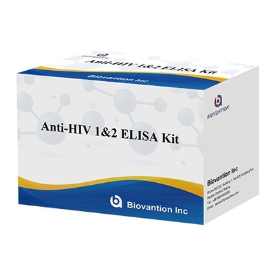 Έλεγχος HIV Elisa Kit 18 μηνών Χρονοδιάστημα ζωής Έλεγχος Elisa με υψηλή ευαισθησία και ειδικότητα