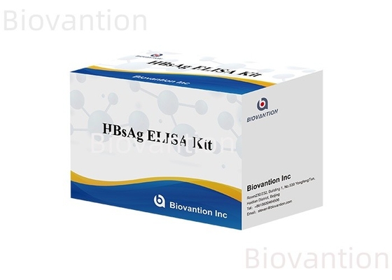 Ακριβής διάγνωση HBsAg σε 2-3 ώρες με το Enzyme-Linked Immunosorbent Test Kit