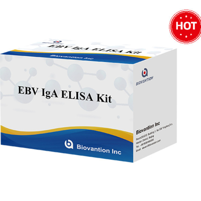 EBV-VCA IgA Ab ELISA Kit Εμφάνιση ανοσολογικών δοκιμών