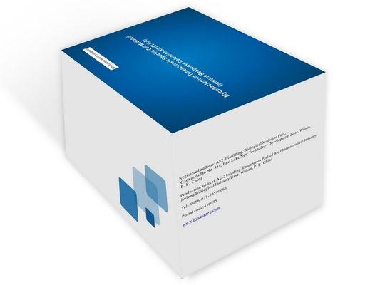 Σόρος Πλάσμα TB-IGRA