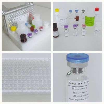 Σόρος Πλάσμα TB-IGRA