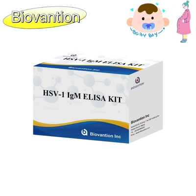 Κίτ δοκιμής ELISA με πυρσό HSV 1 IgM υψηλή θερμή πώληση διαγνωστικό αντιδραστήρα IVD