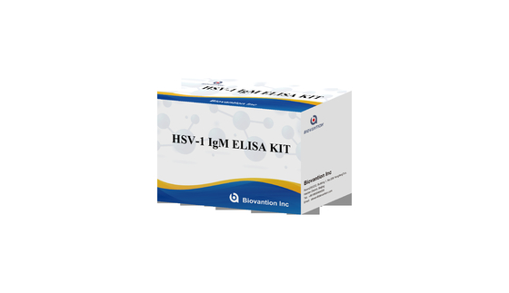 Κίτ δοκιμής ELISA με πυρσό HSV 1 IgM υψηλή θερμή πώληση διαγνωστικό αντιδραστήρα IVD