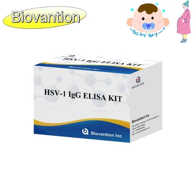 Ελέγχου ΕΛΙΣΑ για τον ιό HSV 1 IgG Torch High Hot Sale Διαγνωστικό αντιδραστήρα IVD