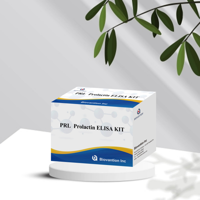PRL Ποσοτική ανθρώπινες ορμόνες Διαγνωστικό ανιχνευτικό εργαλείο