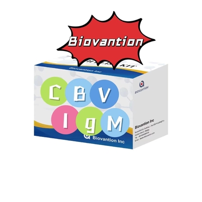 Δοκιμαστικό κιτ για αντισώματα IgM κατά CBV Elisa Test Kit 50μL ορό ιατρική διάγνωση