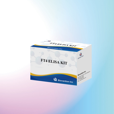 Το TOXO IgM IgG igg igm kit elisa για ανθρώπινη χρήση kit δοκιμής διαγνωστικού αντιδραστήρα με 96 kit