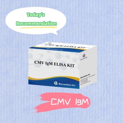 Δοκιμή ELISA ποιότητας IgM των μακροφάγων IVD Πειραματικό κιτ Υψηλή ευαισθησία