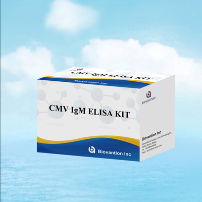 Δοκιμή ELISA ποιότητας IgM των μακροφάγων IVD Πειραματικό κιτ Υψηλή ευαισθησία