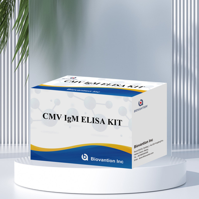 Δοκιμή ELISA ποιότητας IgM των μακροφάγων IVD Πειραματικό κιτ Υψηλή ευαισθησία