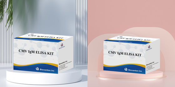 Δοκιμή ELISA ποιότητας IgM των μακροφάγων IVD Πειραματικό κιτ Υψηλή ευαισθησία
