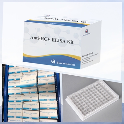 Νέο φθινόπωρο IVD αντιδραστήρα HCV Διαγνωστικό αντιδραστήρα Δοκιμή για ανθρώπινο νοσοκομειακό κλινικό εργαστήριο