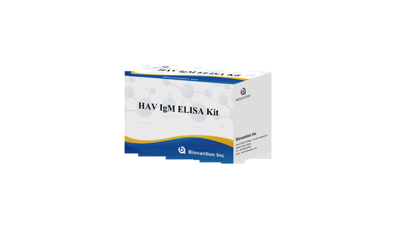 HAV IgM Elisa Test Ηπατίτιδα A Διαγνωστικό Κιτ Εμφυτοενζυμική ανοσολογική δοκιμή