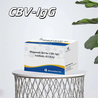Υψηλής ειδικότητας αντισώματα CBV-IgG ανιχνεύουν τον άνθρωπο Ελίζα κιτ για ακριβή ανίχνευση των αναλυτών-στόχων