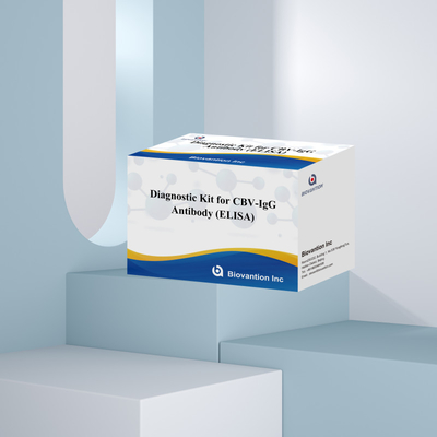Υψηλής ειδικότητας αντισώματα CBV-IgG ανιχνεύουν τον άνθρωπο Ελίζα κιτ για ακριβή ανίχνευση των αναλυτών-στόχων