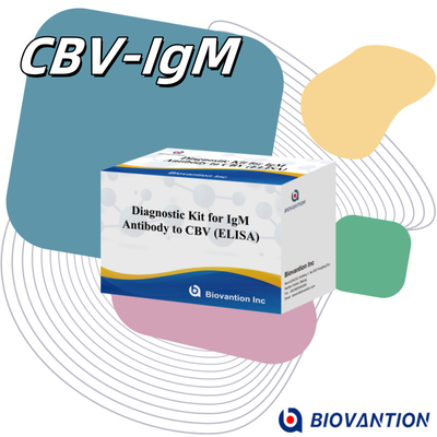 CBV igm ELISA KIT D διαγνωστικό αντιδραστήρα 18 μήνες Χρονοδιάστημα ισχύος Ενζυμικά συνδεδεμένο ελεγχόμενο ελεγχόμενο ανοσοσυλλεκτικό