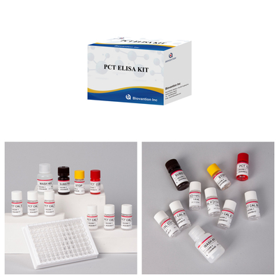 Μεθοδολογία ELISA υψηλής ακρίβειας PCT για ανίχνευση αντιδραστηρίου στον άνθρωπο με δοκιμή 96 για νοσοκομείο