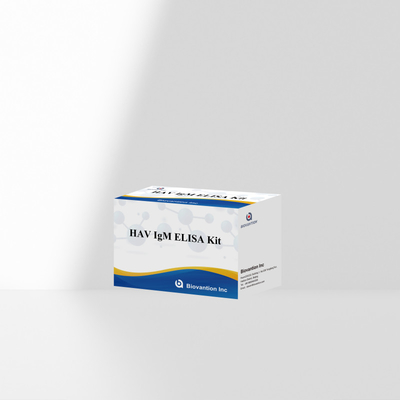 HAV IgM ELISA Kit Υψηλή ευαισθησία Ηπατίτιδα Α Ανίχνευση ιού Αξιόπιστο ακριβές διαγνωστικό τεστ για κλινικά εργαστήρια