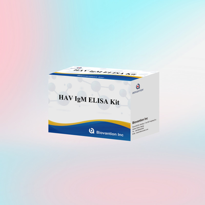 HAV IgM ELISA Kit Υψηλή ευαισθησία Ηπατίτιδα Α Ανίχνευση ιού Αξιόπιστο ακριβές διαγνωστικό τεστ για κλινικά εργαστήρια
