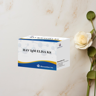 HAV IgM ELISA Kit Υψηλή ευαισθησία Ηπατίτιδα Α Ανίχνευση ιού Αξιόπιστο ακριβές διαγνωστικό τεστ για κλινικά εργαστήρια
