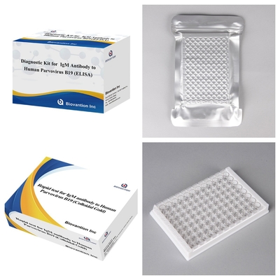 Προηγμένο Human Parvovirus B19 IgM Antibody ELISA Test Kit για την ανίχνευση και τον έλεγχο της εγκυμοσύνης