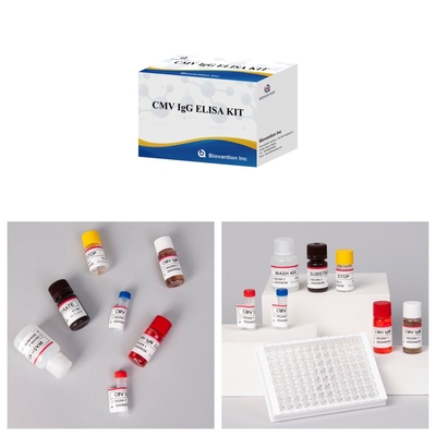 Υψηλής ευαισθησίας δοκιμαστική συσκευή CMV Elisa για ακριβή και ακριβή αποτελέσματα
