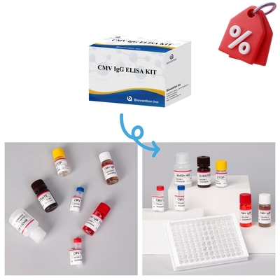 Υψηλής ευαισθησίας δοκιμαστική συσκευή CMV Elisa για ακριβή και ακριβή αποτελέσματα
