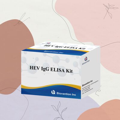 Κιτ ELISA HEV-IgG Υψηλής Ευαισθησίας με Μέγεθος 96T και Διάρκεια Ζωής 18 Μηνών για τη Διάγνωση της Ηπατίτιδας Ε