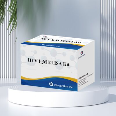 Υψηλής ευαισθησίας τεστ ELISA IgM HEV με μέγεθος 96T και χρόνο δοκιμής 2-3 ωρών για ακριβή διάγνωση