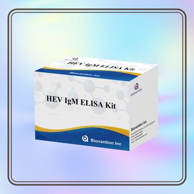 Υψηλής ευαισθησίας τεστ ELISA IgM HEV με μέγεθος 96T και χρόνο δοκιμής 2-3 ωρών για ακριβή διάγνωση