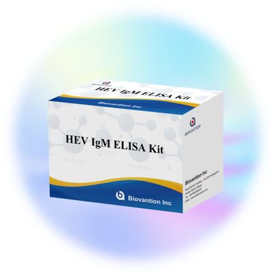 Υψηλής ευαισθησίας τεστ ELISA IgM HEV με μέγεθος 96T και χρόνο δοκιμής 2-3 ωρών για ακριβή διάγνωση