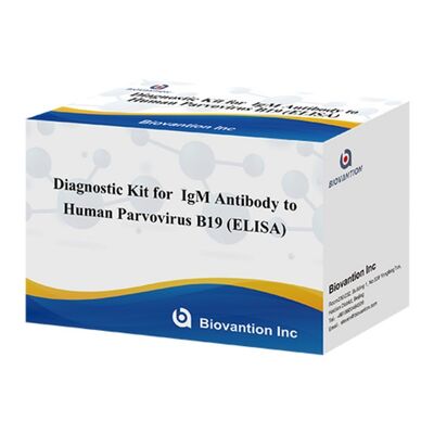 Άμεση Πώληση από το Εργοστάσιο 96T ELISA Test Kit για Ανθρώπινα Αντισώματα IgM του Παρβοϊού Β19 με Χρωματομετρική Ανίχνευση και Διάρκεια Ζωής 18 Μηνών