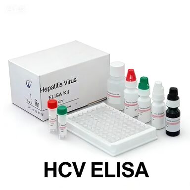 Κιτ Δοκιμής Elisa Anti-HCV με Υψηλή Ειδικότητα για 96 Δοκιμές και Χρόνο Δοκιμασίας 1,5-3 Ώρες