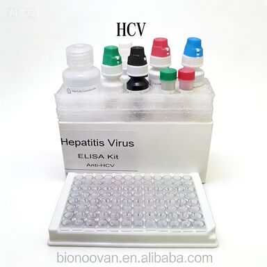 Κιτ Δοκιμής Elisa Anti-HCV με Υψηλή Ειδικότητα για 96 Δοκιμές και Χρόνο Δοκιμασίας 1,5-3 Ώρες