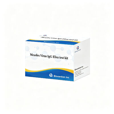 Κιτ δοκιμής IgG ELISA για τον ιό της ιλαράς Ειδικότητα υψηλής ευαισθησίας