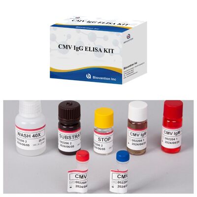 Σετ δοκιμής ELISA 96T CMV με χρωματομετρική ανίχνευση και μέθοδο σάντουιτς για αντισώματα κυτταρομεγαλοϊού